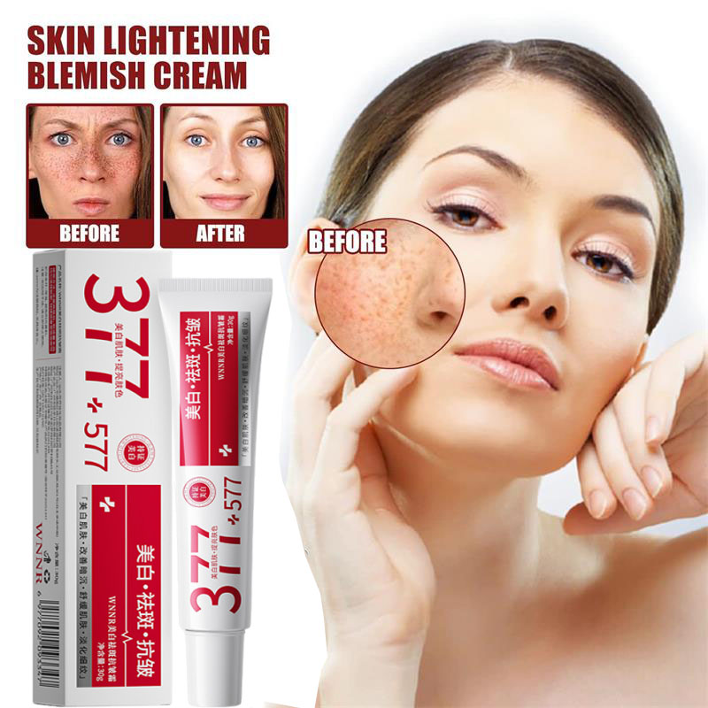 Charcoal Whitening Paste - Leistungsstarke Fleckenentfernungs- und Aufhellungscreme, hellt die
