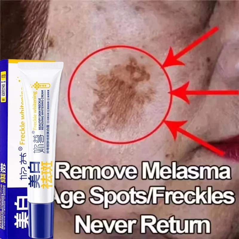Charcoal Whitening Paste - Leistungsstarke, fleckenentfernende Aufhellungscreme, hellt die Haut