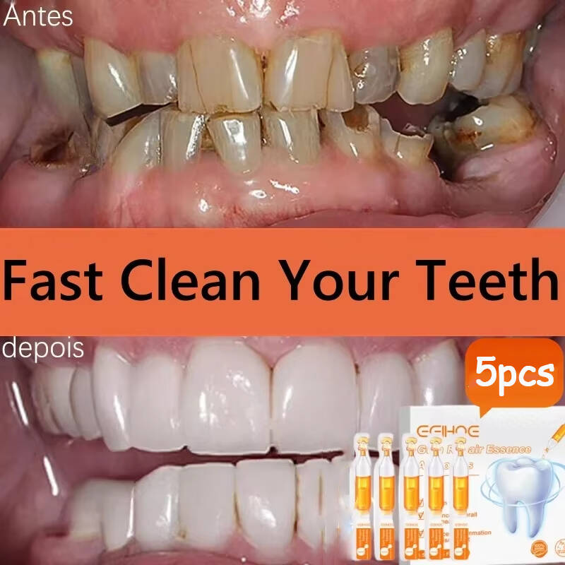 Teeth Whitening With Baking Soda - Schnell reparierendes Zahnfleischserum, lindert Nachwachsen von