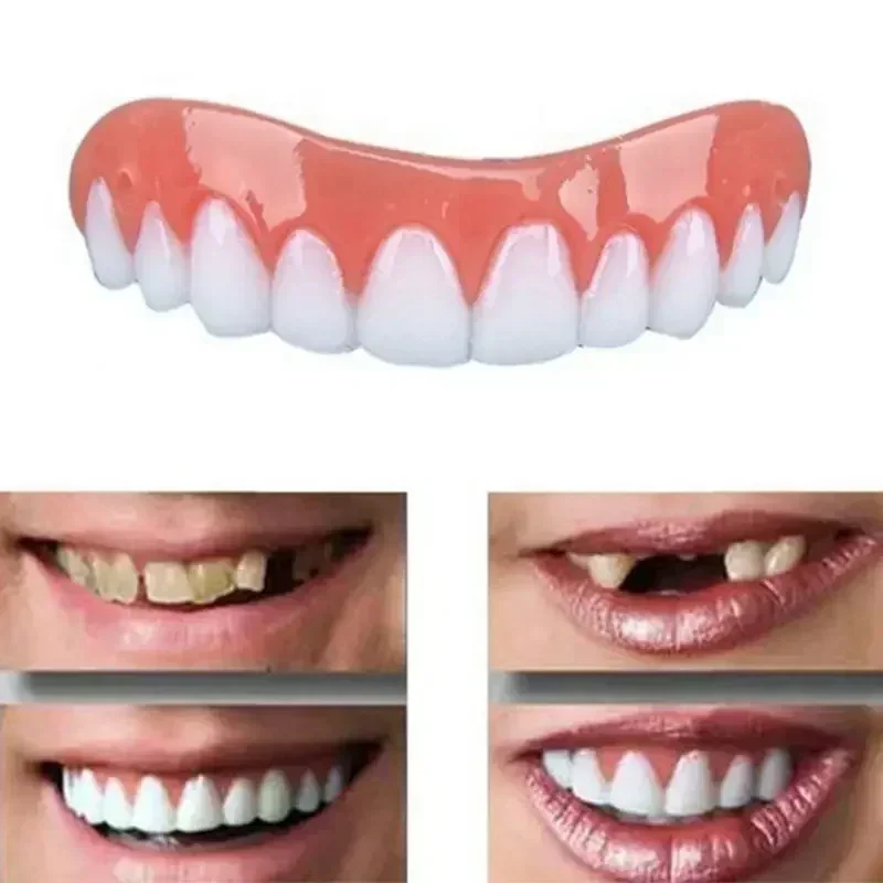 Teeth Whitening With Braces - Neue Silikon-Zahnprothesen für Ober- und Unterkiefer,