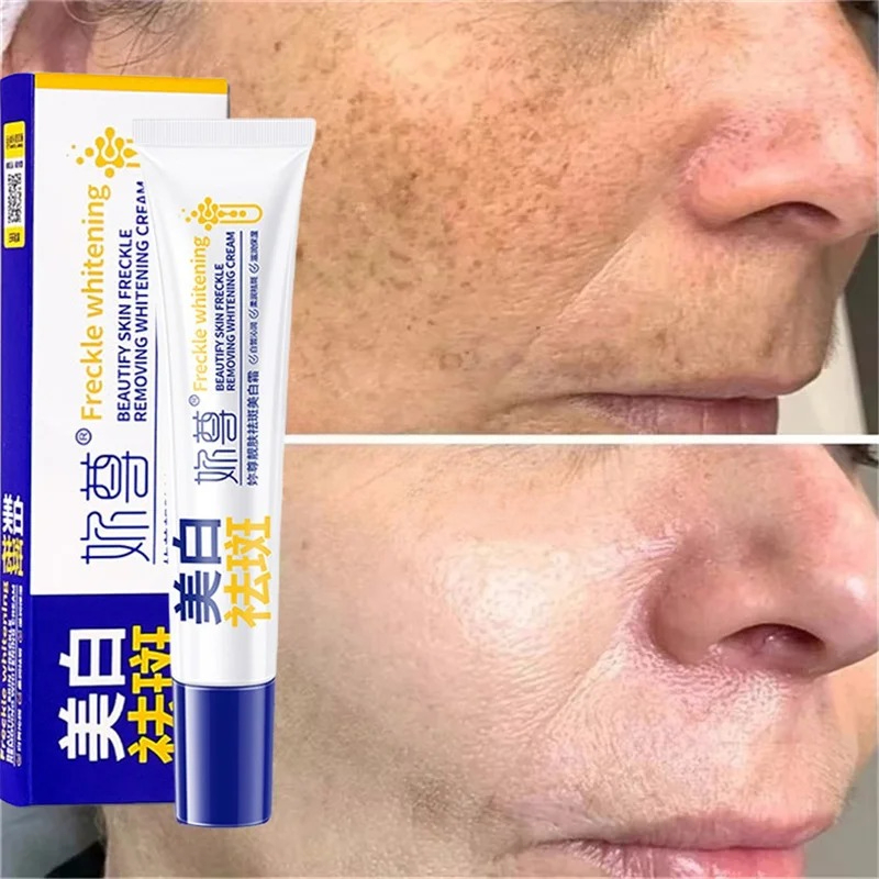 Leistungsstarke, fleckenentfer – Charcoal Whitening Paste Bewertung und Preis