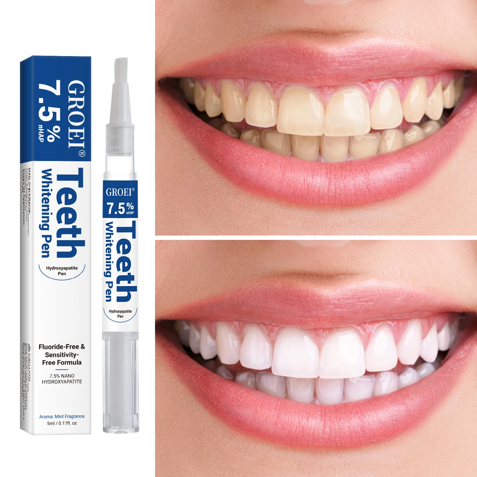 Hydroxyapatite Zahnaufhellungs – Teeth Whitening Hydrogen Peroxide Bewertung und Preis