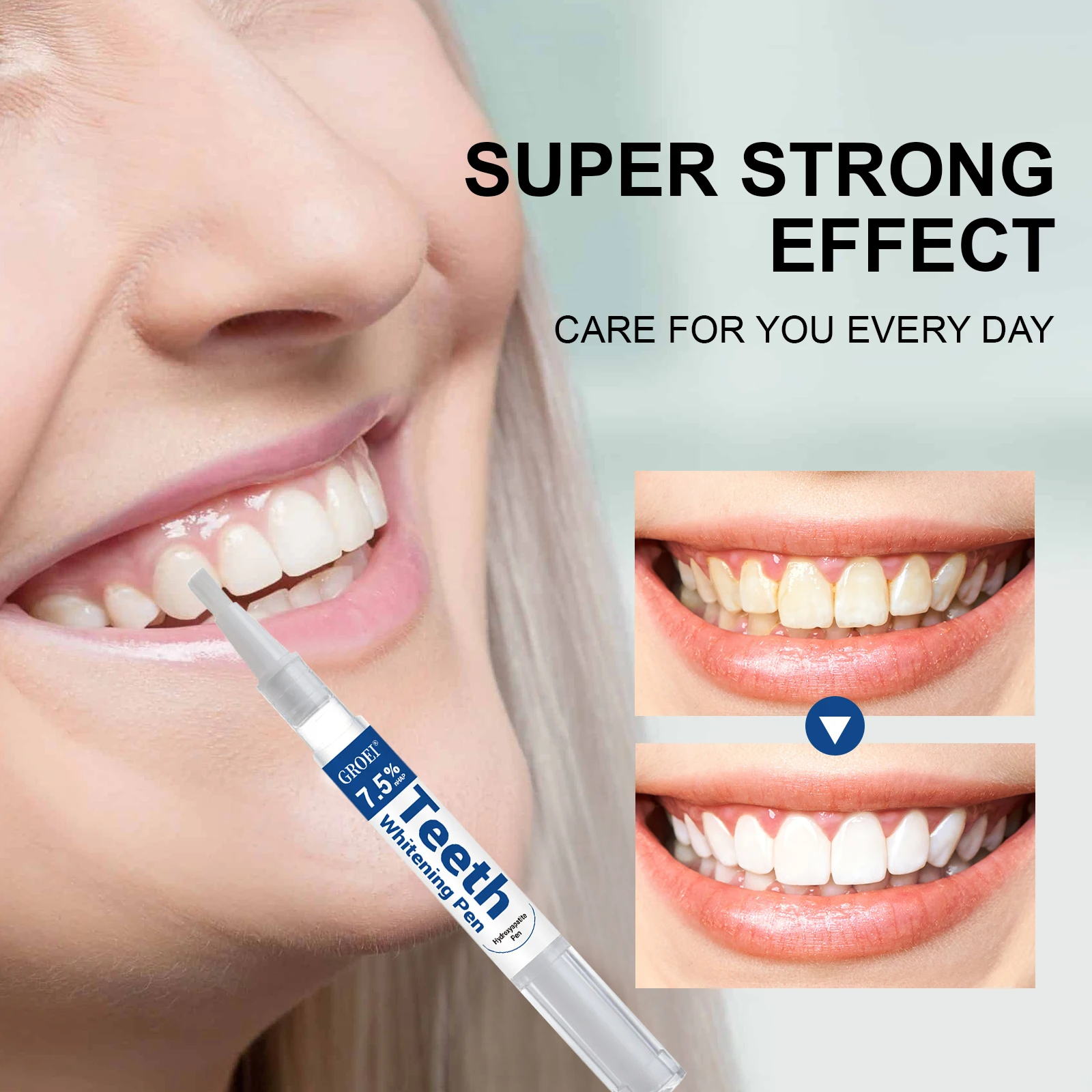 Hydroxyapatite Zahnaufhellungs – Teeth Whitening Hydrogen Peroxide Bewertung und Preis