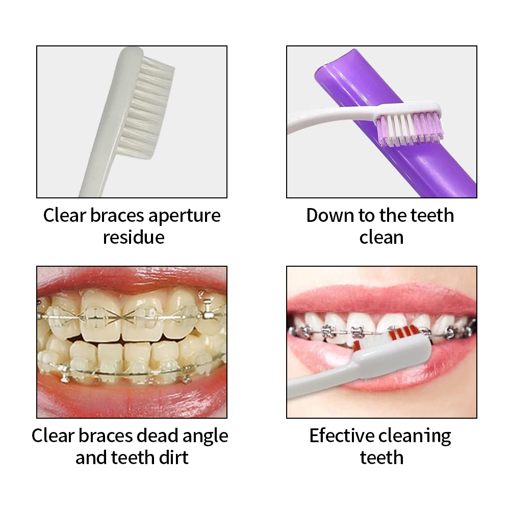 8 Teile/satz Kieferorthopädisc – Teeth Whitening With Braces Bewertung und Preis