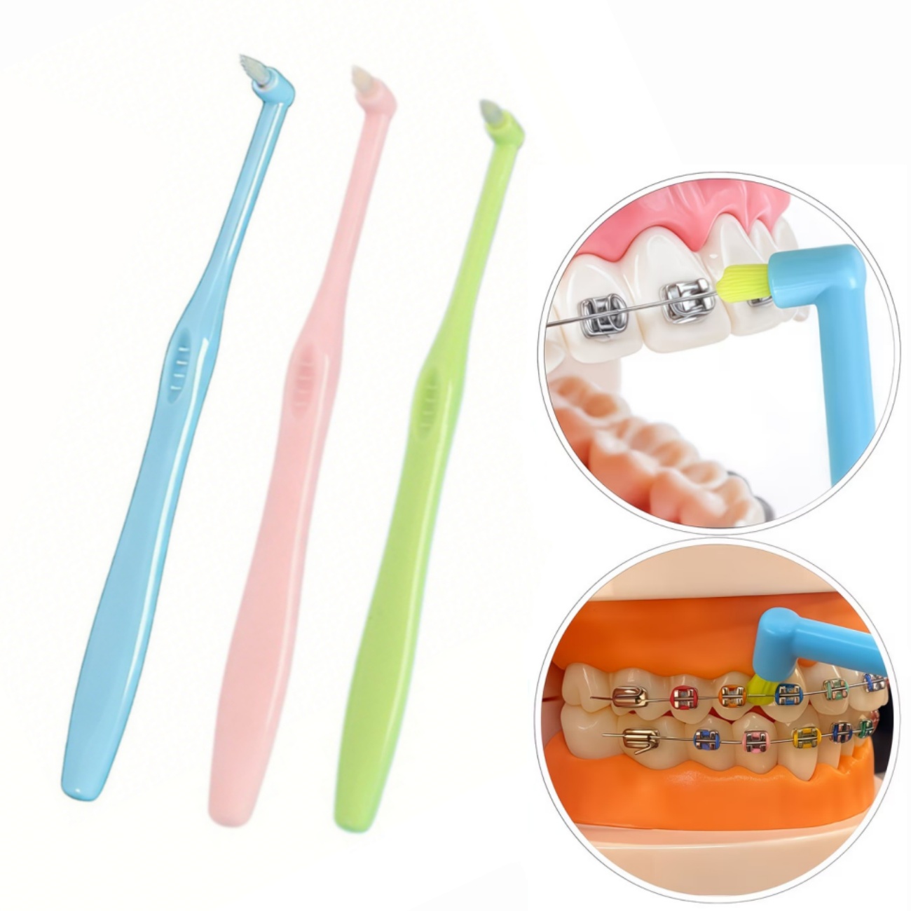 1/3 Stück Zahnspangen-Zahnbürs – Teeth Whitening With Braces Bewertung und Preis