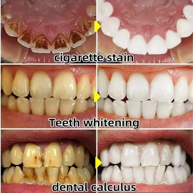 Schnell reparierendes Zahnflei – Teeth Whitening With Baking Soda Bewertung und Preis