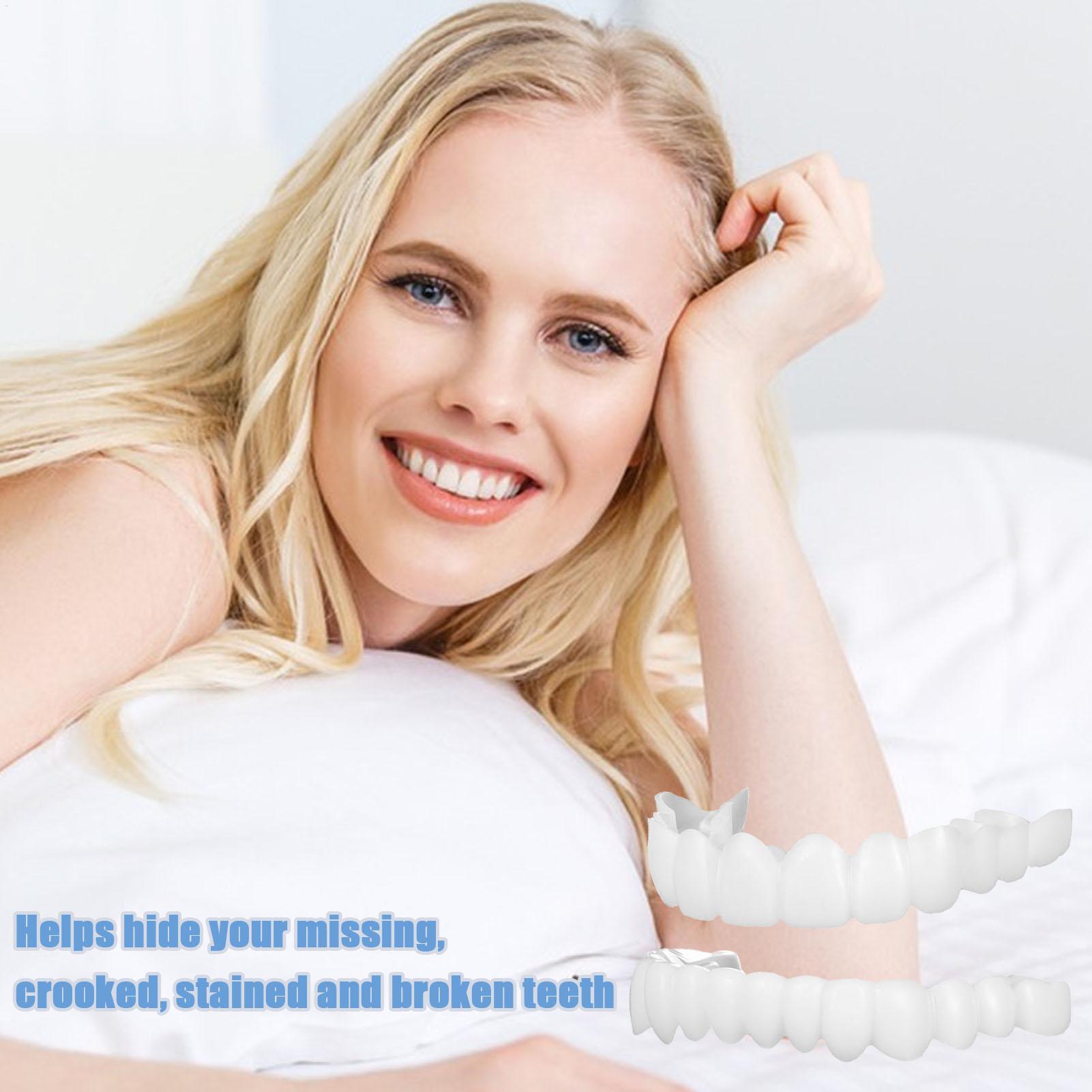 Zahnprothesen für Ober- und Un – Teeth Whitening With Braces Bewertung und Preis