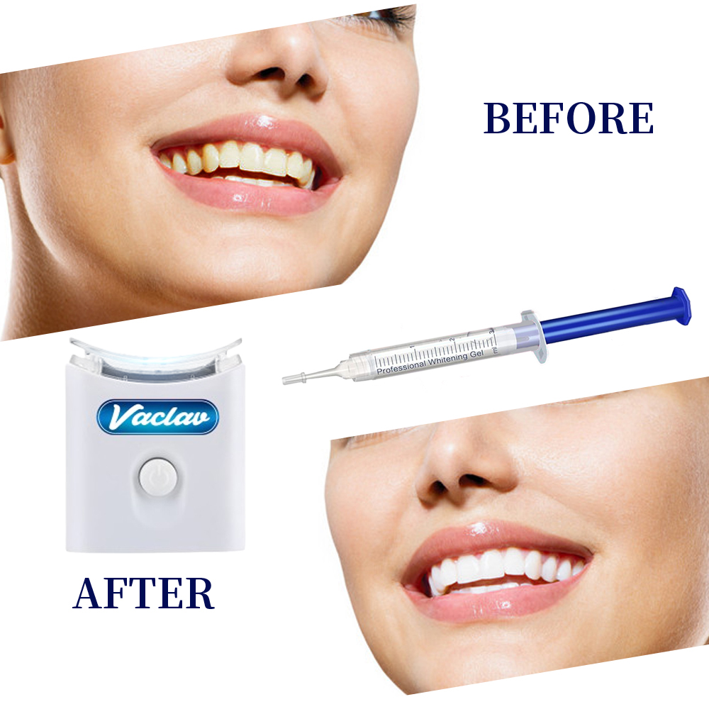 Minze Zähne Bleaching Gel Spri – Teeth Whitening With Baking Soda Bewertung und Preis