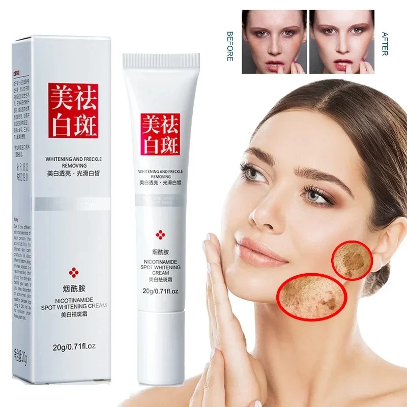 Verblasst und verbessert Somme – Charcoal Whitening Paste Bewertung und Preis