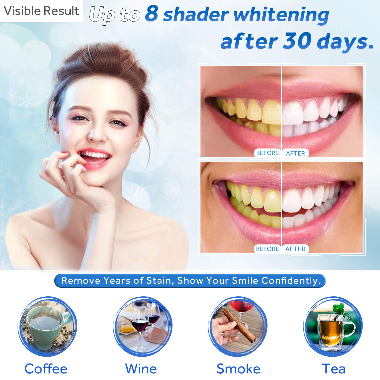 Zahnaufhellungsgel, Nachfüllsp – Teeth Whitening Hydrogen Peroxide Bewertung und Preis