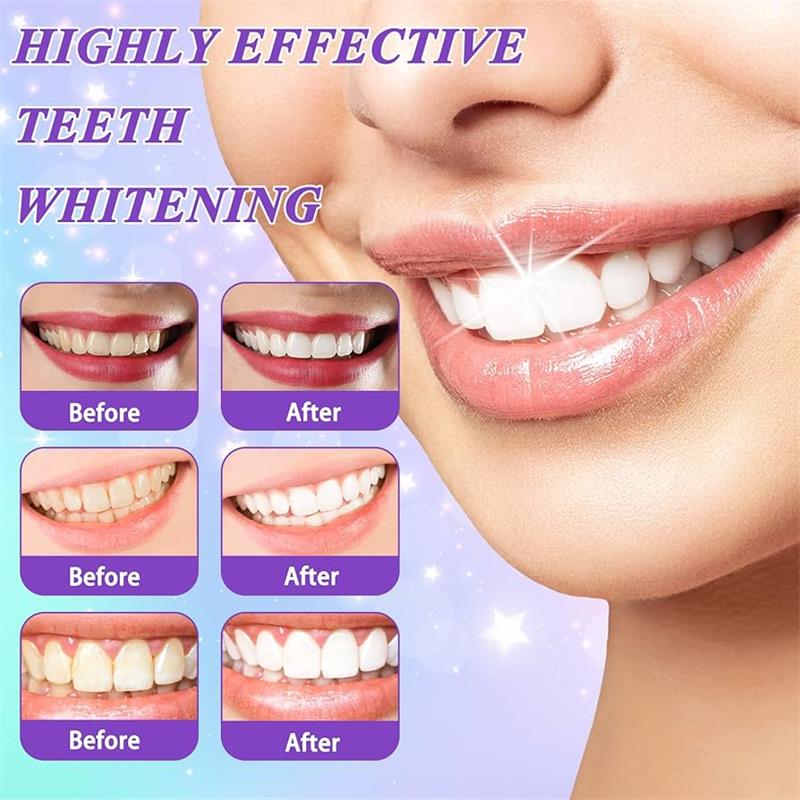 9D Lila Zahnaufhellungs-Zahnpa – Teeth Whitening Natural Bewertung und Preis
