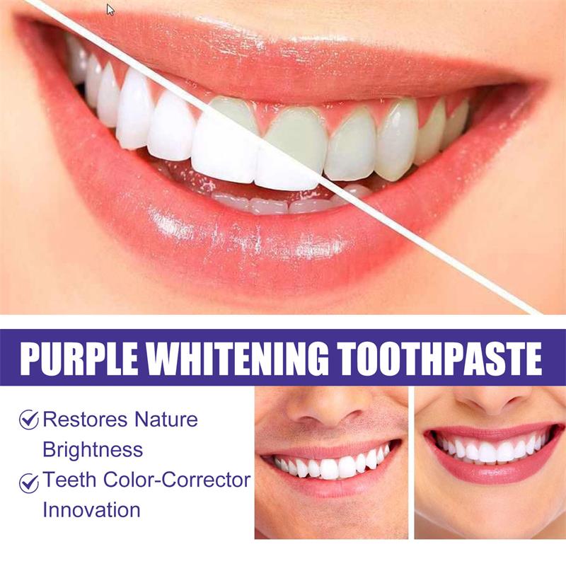 9D Lila Zahnaufhellungs-Zahnpa – Teeth Whitening Natural Bewertung und Preis
