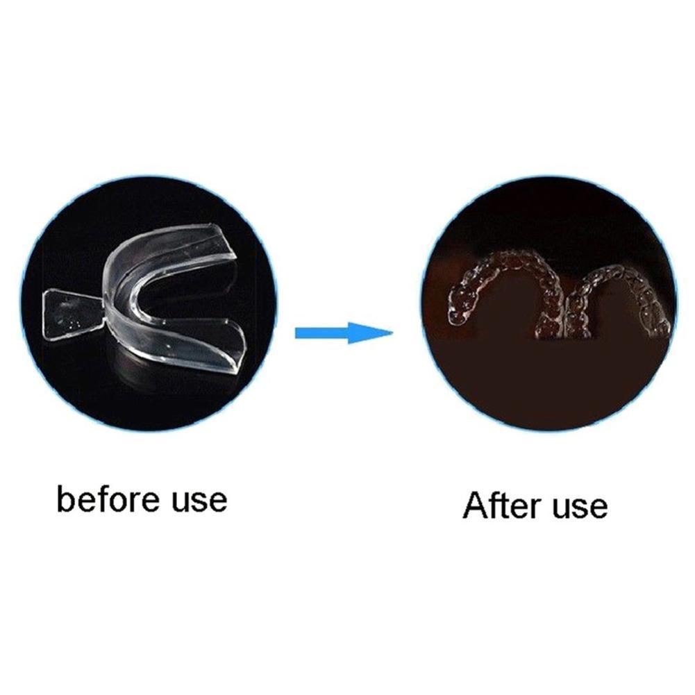 Silikon-Mundschutz für kiefero – Teeth Whitening With Braces Bewertung und Preis