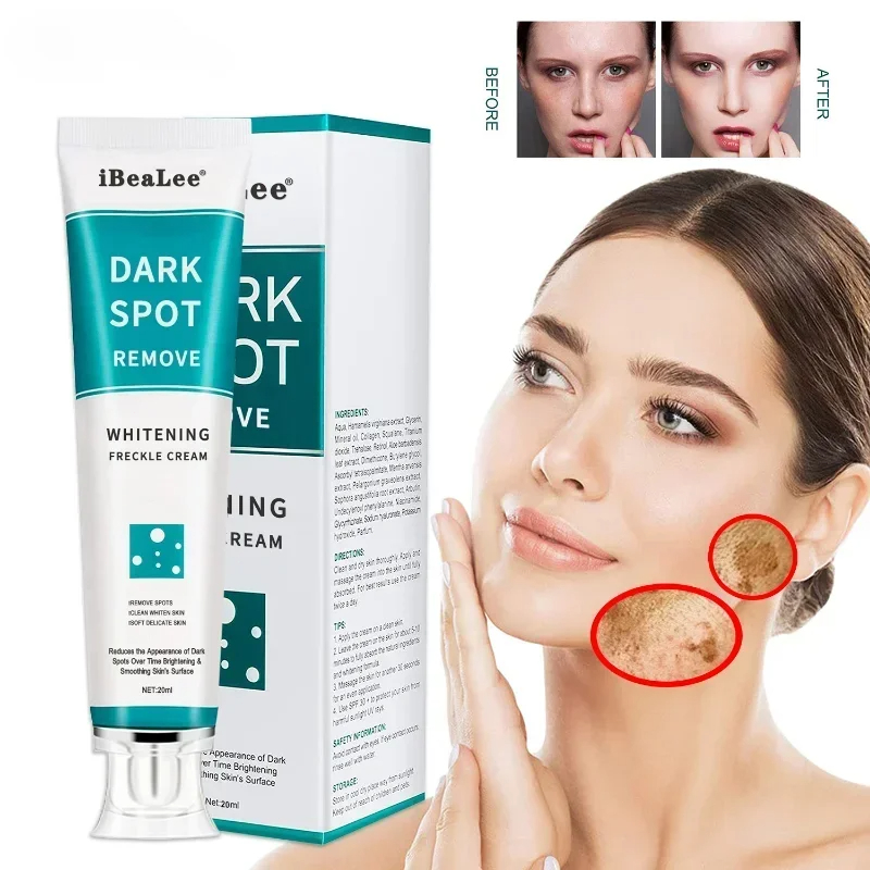 Bleaching Sommersprossen Creme – Charcoal Whitening Paste Bewertung und Preis