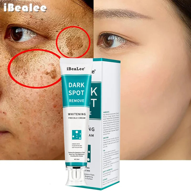 Bleaching Sommersprossen Creme – Charcoal Whitening Paste Bewertung und Preis