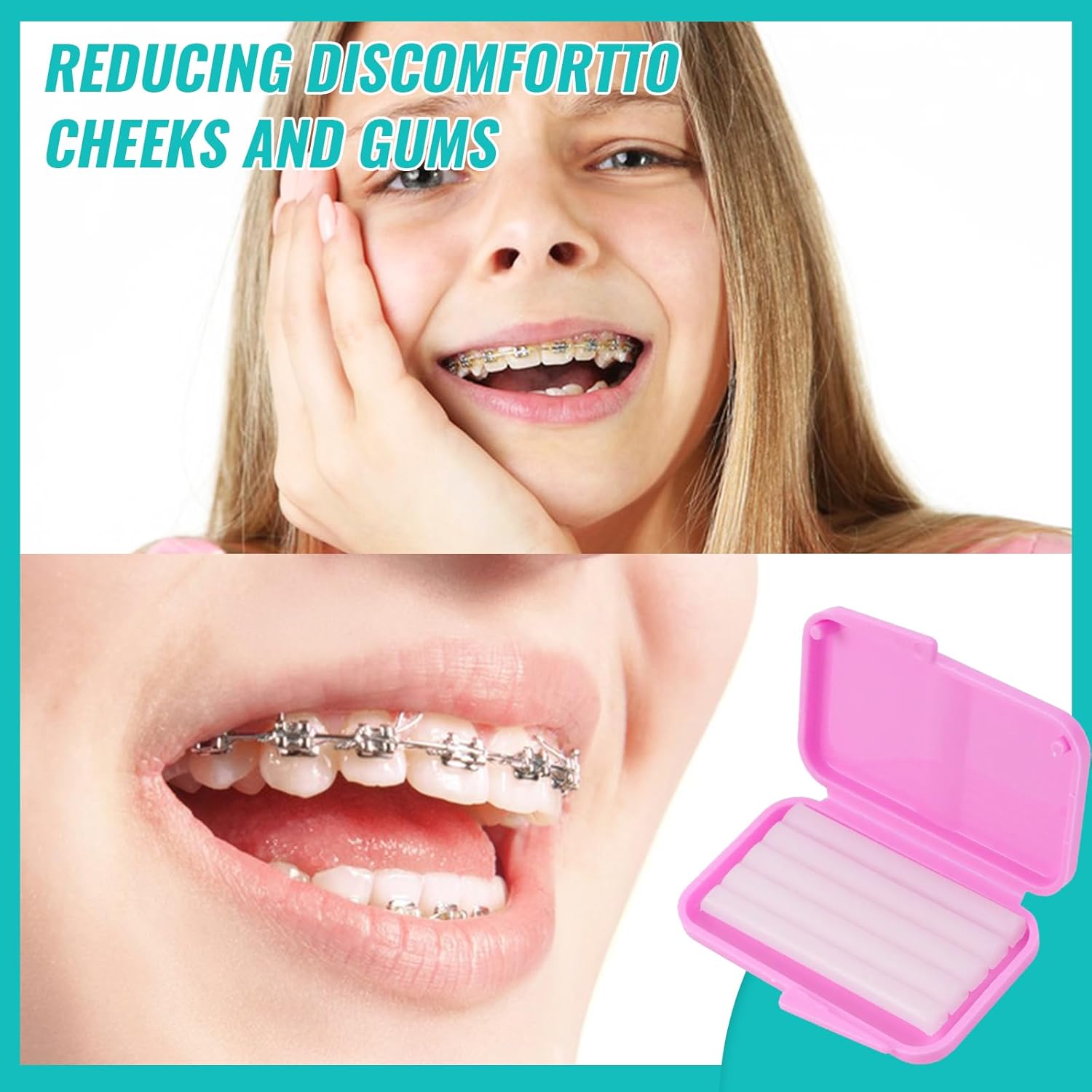 10 box Dental Kieferorthopädis – Teeth Whitening With Braces Bewertung und Preis