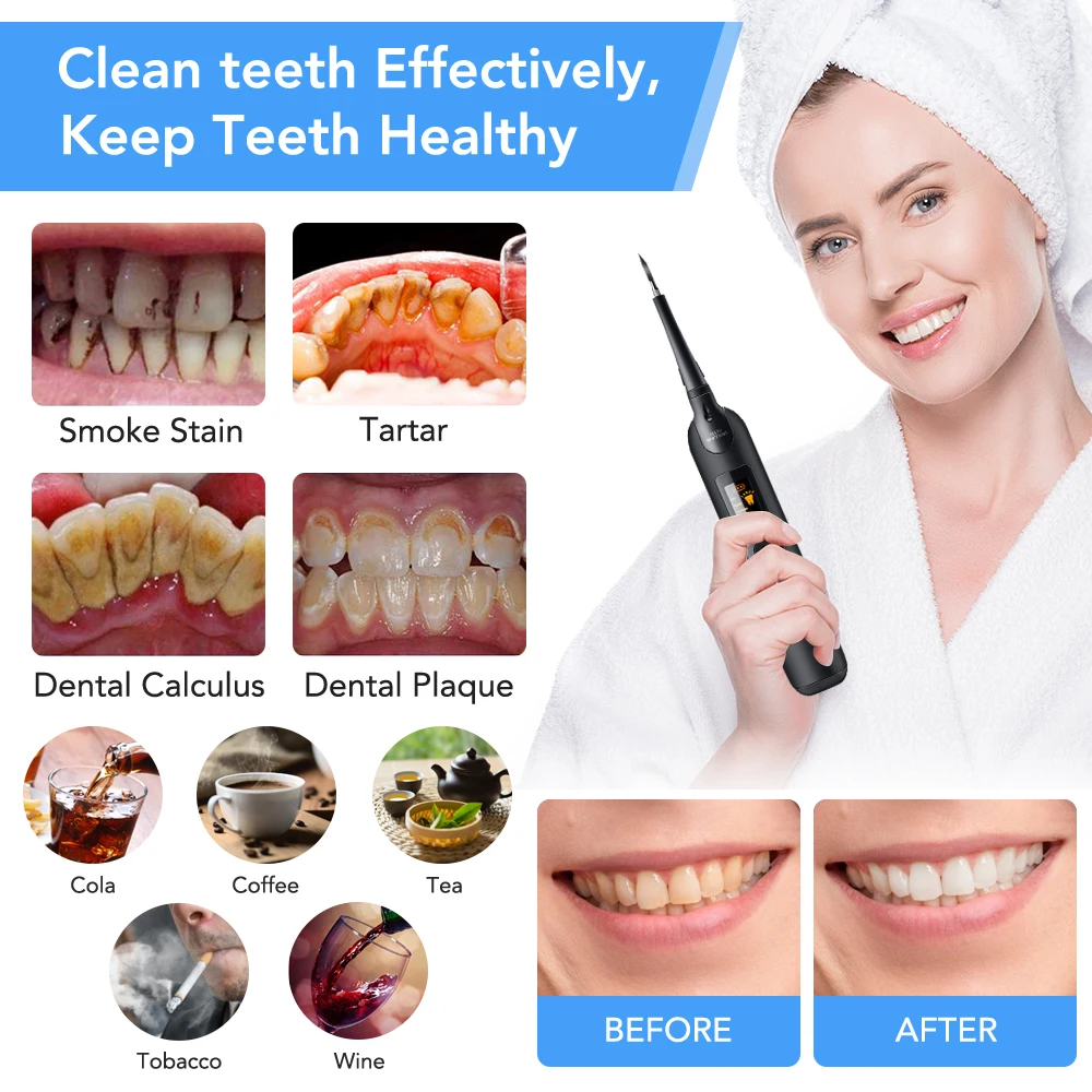 Elektrische Dental Scaler Zahn – Teeth Whitening Toothbrush Bewertung und Preis