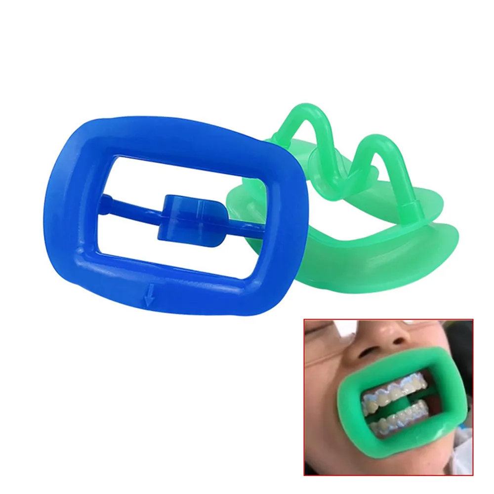 Weicher Mundöffner aus Silikon – Teeth Whitening Fast Bewertung und Preis